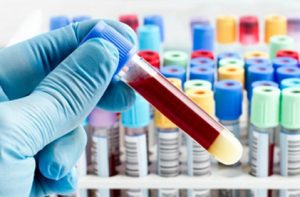 Laboratório é isento de indenização quando não há prova de erro em exame