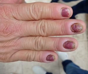 Mais de 20 paraibanos foram resgatados de trabalho análogo à escravidão em 2022, diz SIT